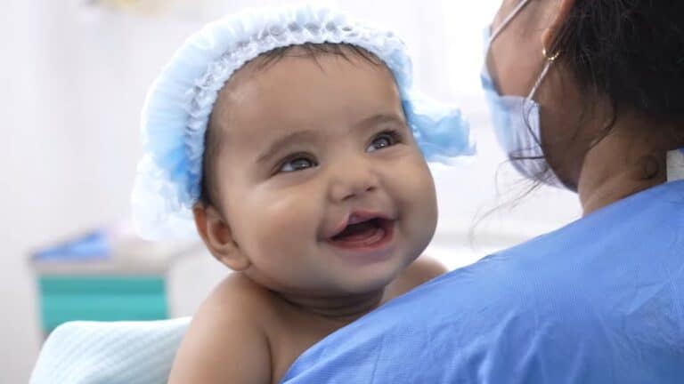 What Age Is Best for Cleft Lip Repair? Expert Insights