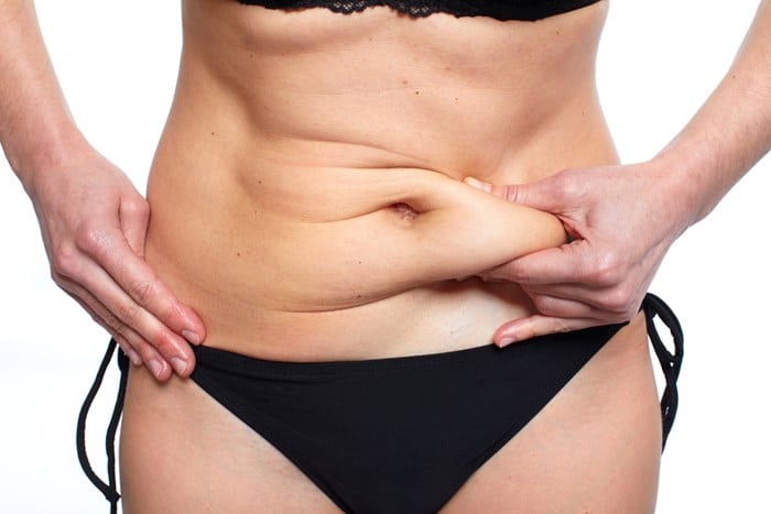 Achieve Your Ideal Waistline: Kybella Injections for Abdomen Shaping