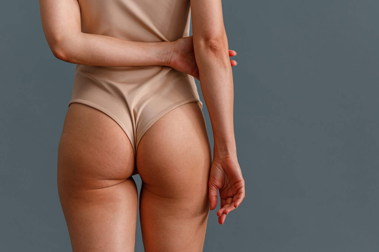 Brazilian Butt Lift and Liposuction