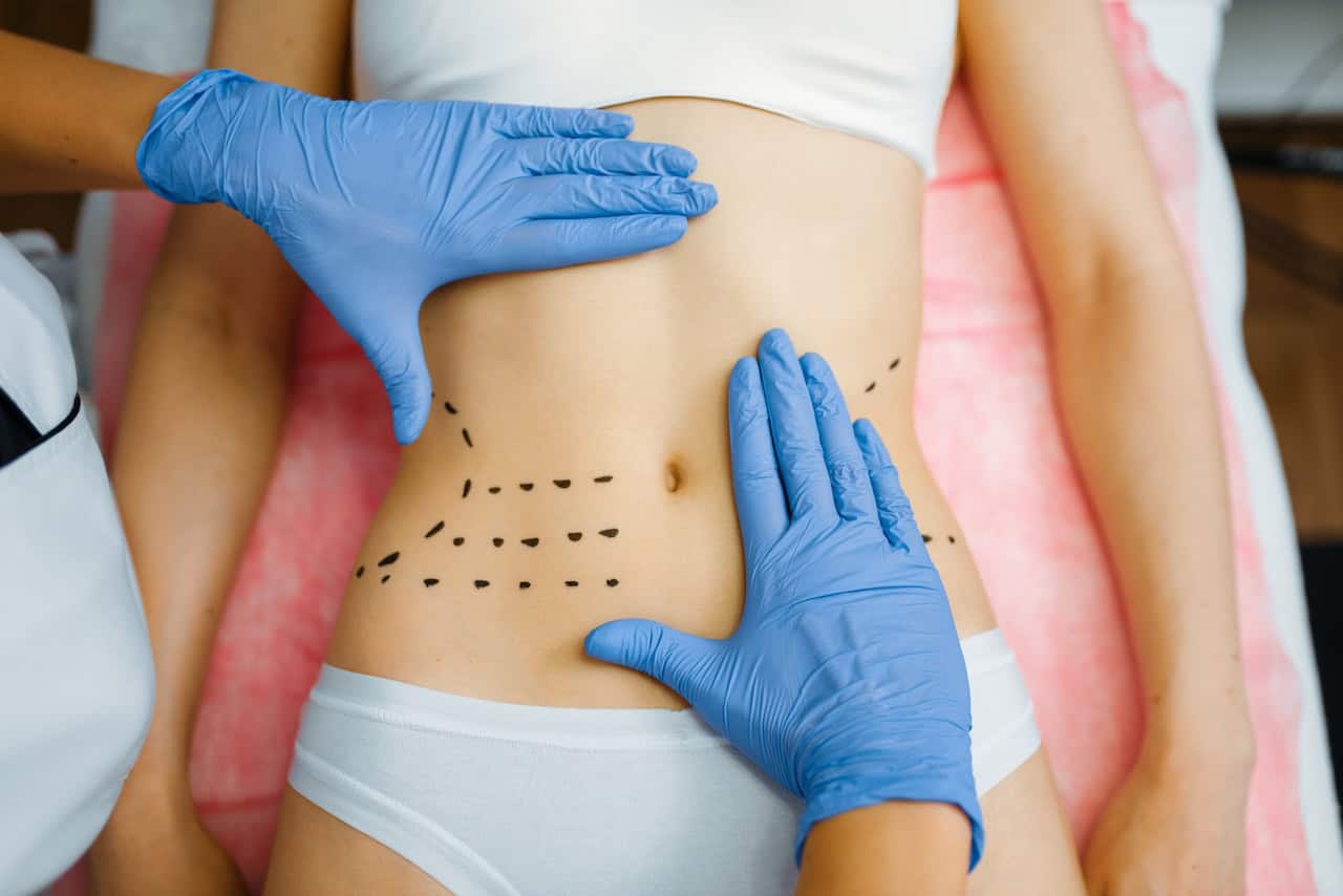 Love Handles Liposuction NYC